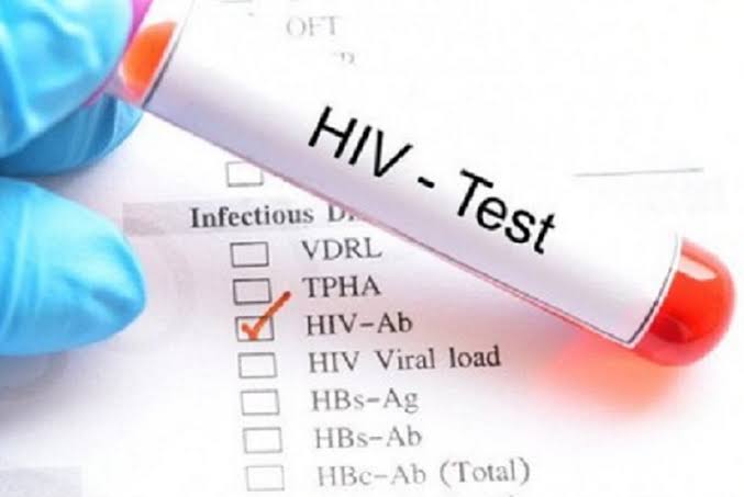 hiv/aids